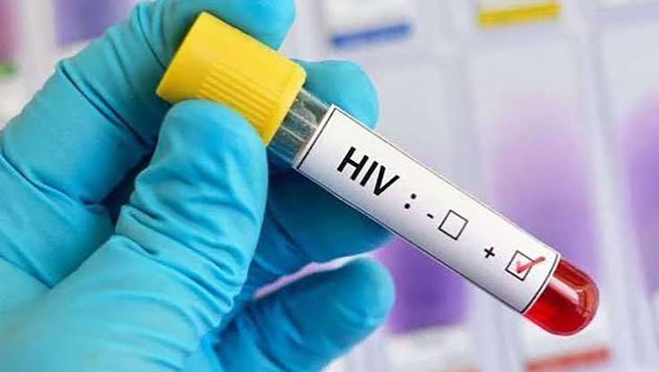 Sri Lanka Reports Rising HIV and Sexually Transmitted Infections, Specialists Warn